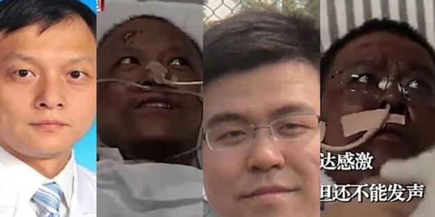 Koronavirüs tedavisi gören doktorların ten renginin değişme nedeni belli oldu!