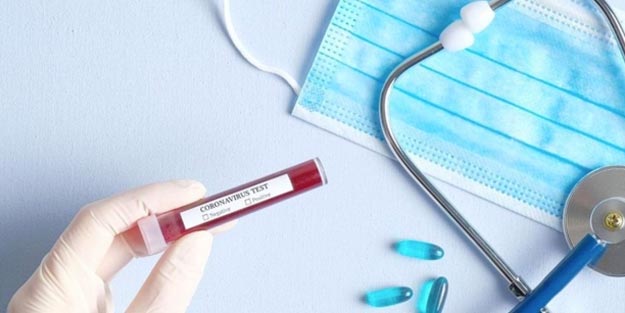 Koronavirüs test ve tedavisini özel sağlık sigortası karşılıyor mu?