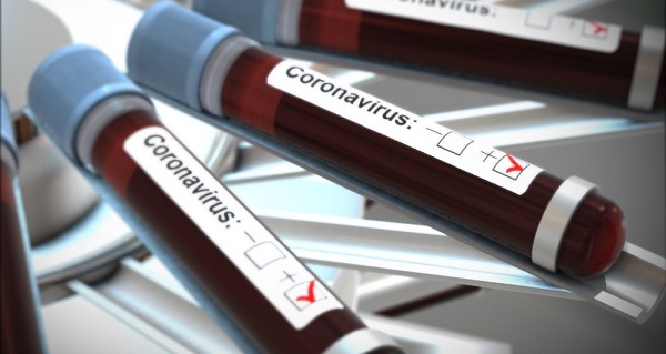 Koronavirüs testi yapan hastaneler hangileri?