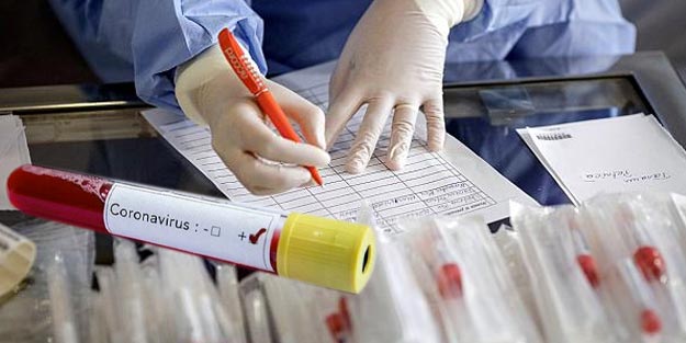 Koronavirüs testleri nerede yapılıyor? Koronavirüs testi yapan iller hangileri?