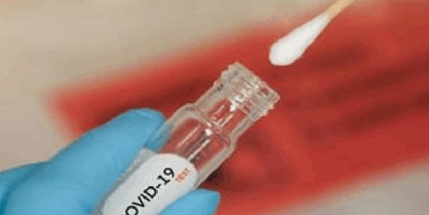 Koronavirüs'de korkutan rapor! Fransa resmen yeni gelişmeyi ilan etti: Eris virüsü için harekete geçti!