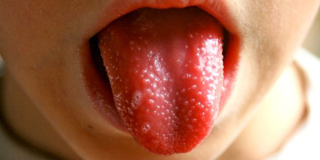 Koronavirüse bağlı çocuk hastalığı İngiltere'nin ardından 5 ülkede daha görüldü