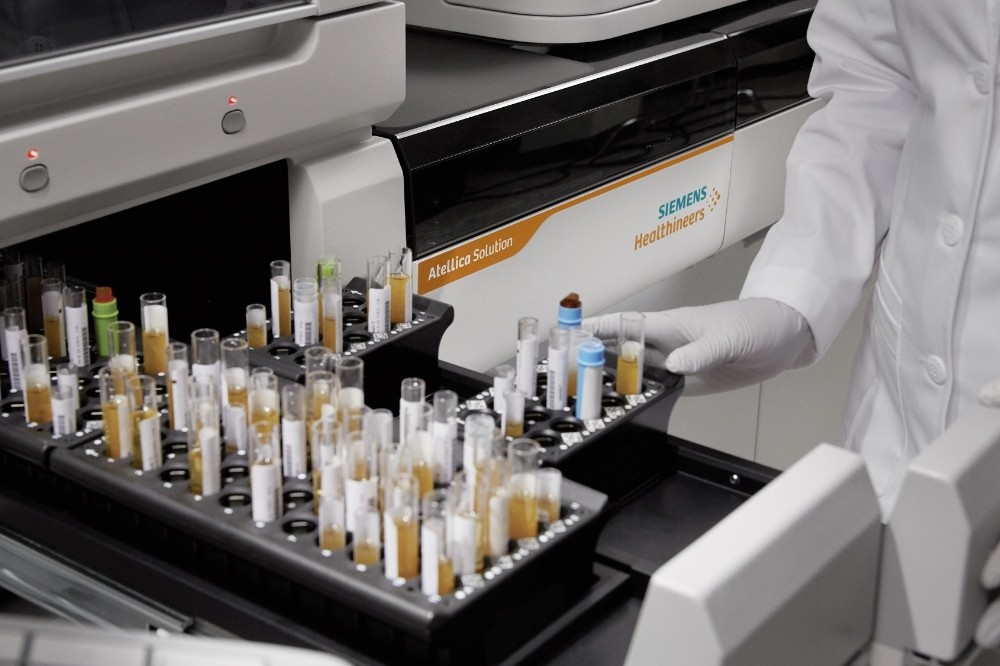 Koronavirüse karşı bağışıklık ölçen test 