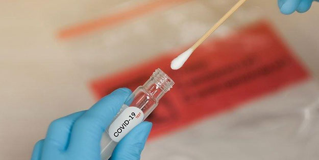 Koronavirüse karşı üretilen antikorlar kalıcı değil