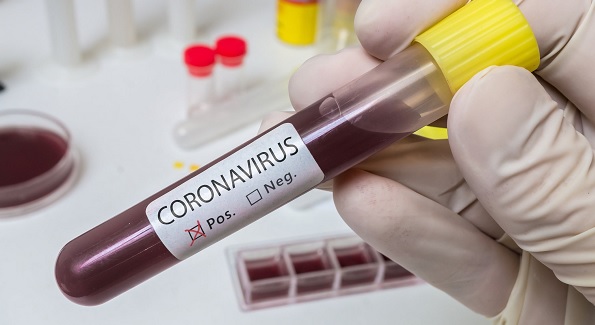 Koronavirüsten kaç kişi öldü? | Coronavirüs son durum 17 Mart 2020