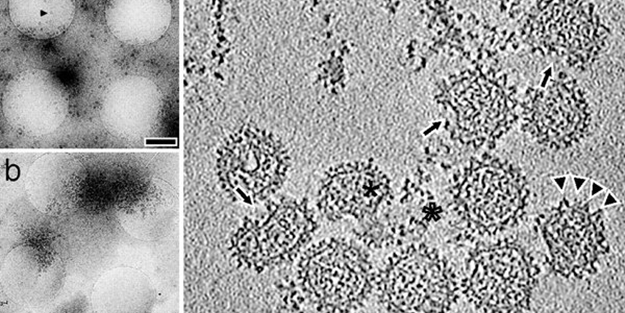 Koronavirüsten sonra şimdi de Bunyavirüs alarmı! İşte belirtileri
