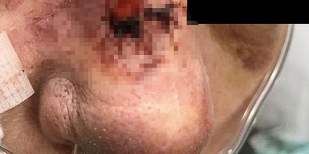 Koronavirüsten sonra yeni kabus! Bulaştığı insanı 1 hafta içerisinde öldürüyor