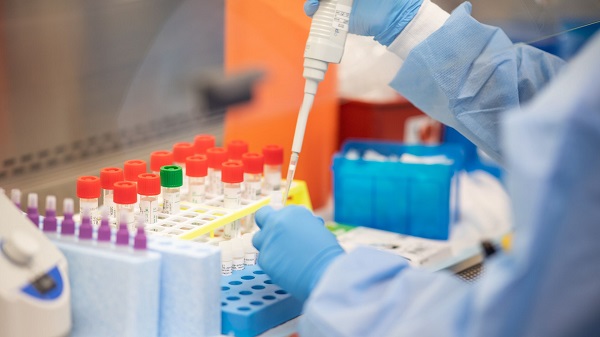 Koronavirüsü testi hangi hastanelerde yapılıyor?