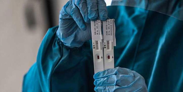 Koronavirüsün gripten ayıran bir özelliği ortaya çıktı