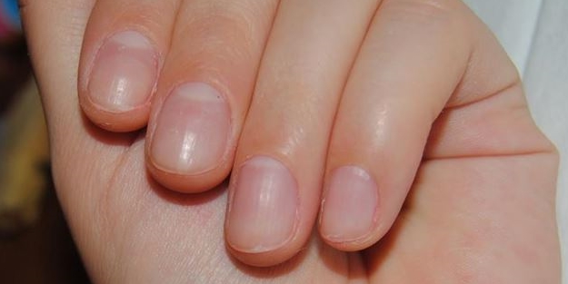 Kozmetik ürünler tırnakları mahvediyor