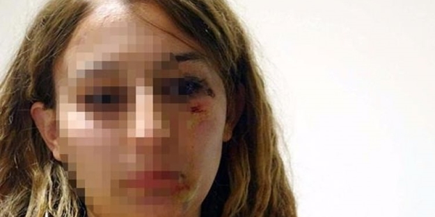 Kuaför kadın polisi dövdü!