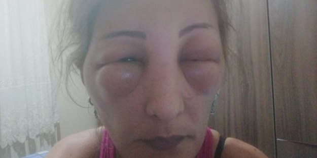 Kuaföre gitti, ölümden döndü!