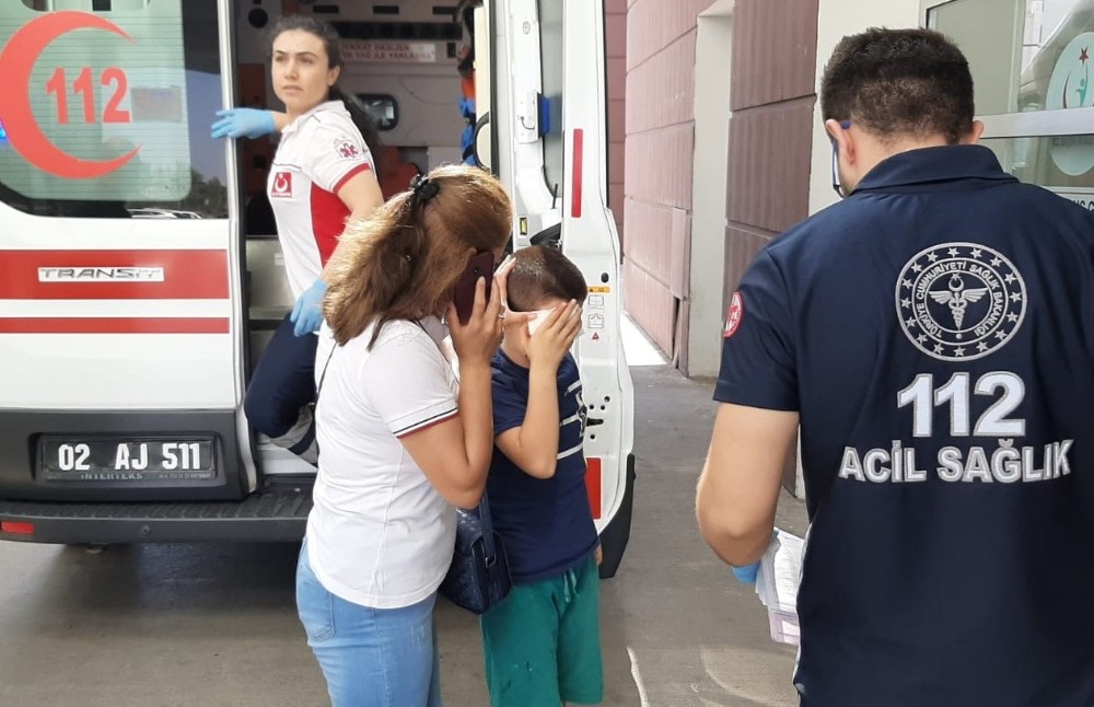 Küçük çocuğun yüzünde maytap patladı 