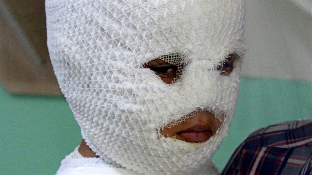 Küçük çocuk süt kazanına düştü