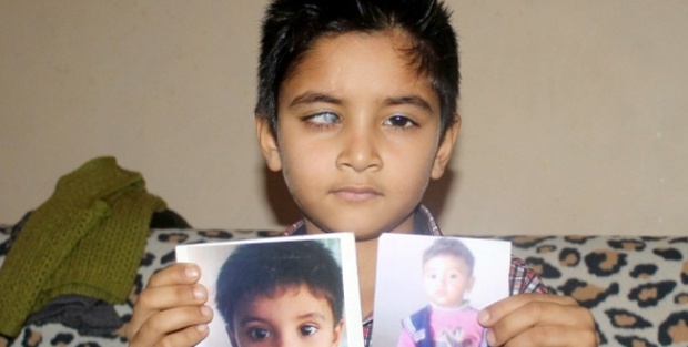 Küçük Kerem görmek için yardım bekliyor