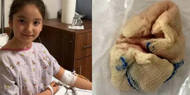 Küçük kızın boğazında unutuldu