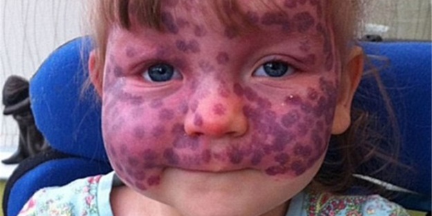 Küçük kızın büyük cesareti - FOTO