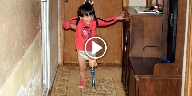 Küçük Özge yeni protezine kavuşmak için gün sayıyor