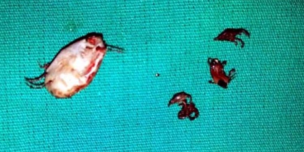 Kulağından bakın ne çıktı!