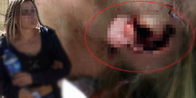 Kulağını ısırarak kopardı! İnanılmaz olay