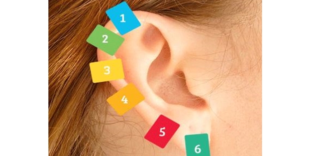 Kulağınızdaki altı farklı noktaya mandal sıkıştırarak vücudunuzun çeşitli bölgelerindeki ağrılardan kurtulun