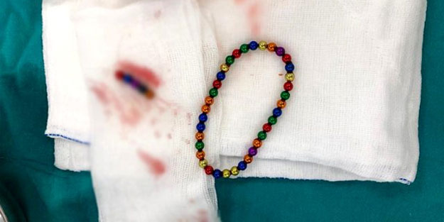 Kusma şikayetiyle doktora giden çocuğun midesinden çıkanlara kimse inanamadı! 