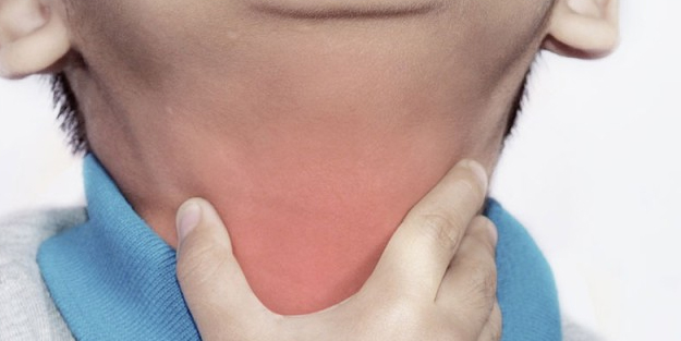 Kuşpalazı (Difteri) nedir? Ölümcül hastalığa karşı korunabilirsiniz: uyku, kalp sağlığını tehdit eden hastalık