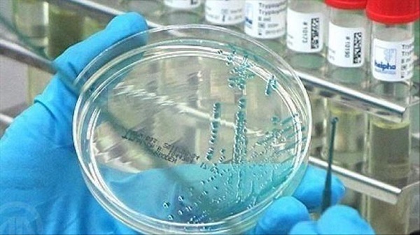 Lassa virüsü nerede görüldü?