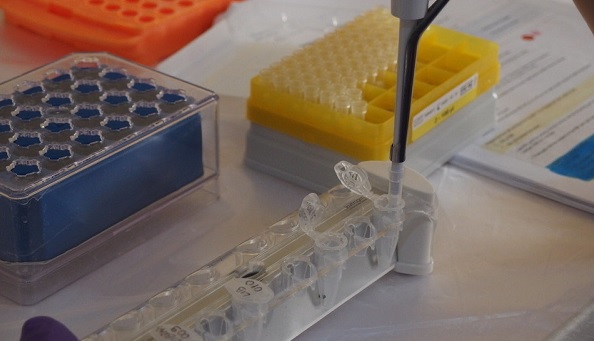 Lassa virüsünden korunmak için neler yapmak gerekir?