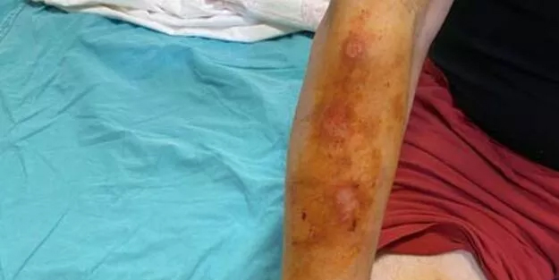 Lavabo açıcı bomba gibi patladı! Dehşeti yaşadı