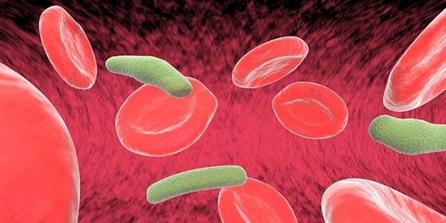 Leptospiroz'un belirtileri nelerdir?