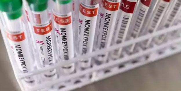 Liberya'da ilk maymun çiçeği vakası tespit edildi