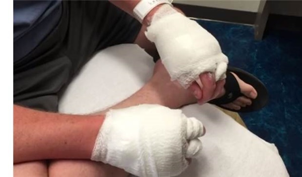 Limonata yaparken dikkat etmezseniz sonunuz böyle olabilir! - FOTO