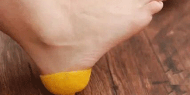 Limonu topuklarınıza sürerseniz bakın ne oluyor! O hastalıkları şıp diye kesiyor