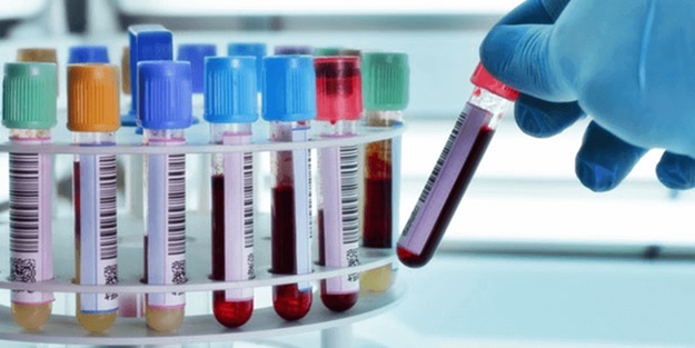 Lipaz yükselmesi nedir?