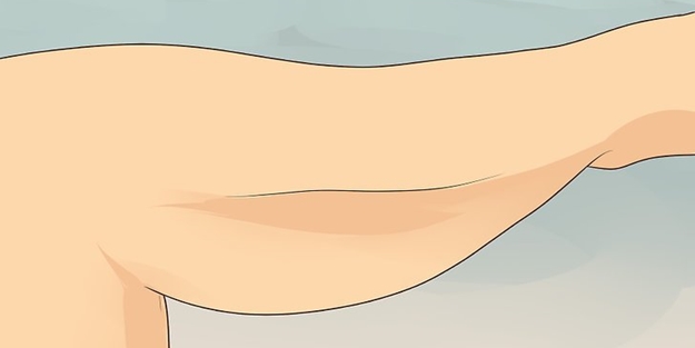 Lipedema nedir? Nasıl tedavi edilir?