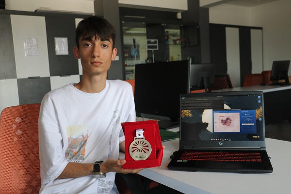 Lise öğrencisi geliştirdi! Cilt kanseri bu yöntemle teşhis edilebilecek