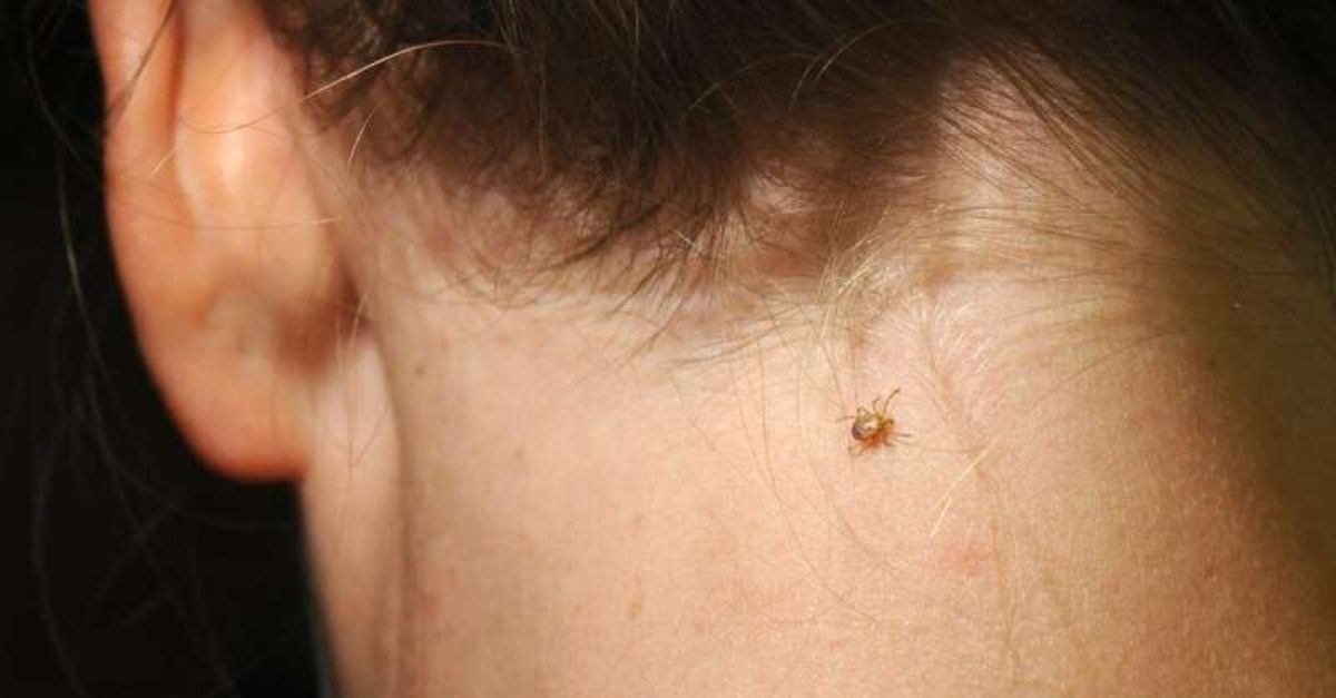 Lyme hastalığı nedir kimlerde görülür? Lyme hastalığı belirtileri nelerdir?
