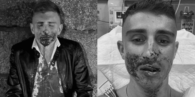 Madalya alamadığı için linç edildi! Avrupa barbarlığı