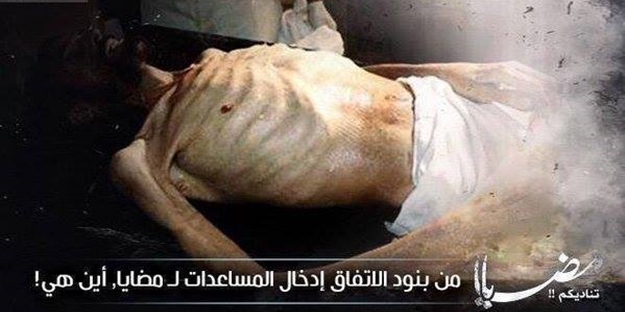 Madaya'da insanlar açlıktan hastalanmaya devam ediyor