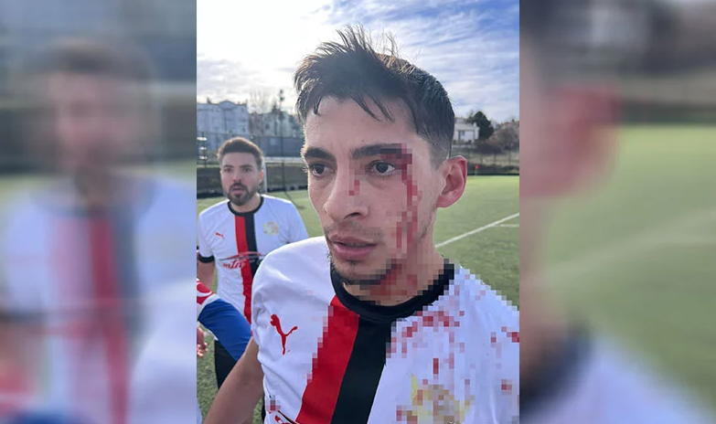 Magandalar sahaya inip kan döktüler! 3 futbolcu hastanelik oldu