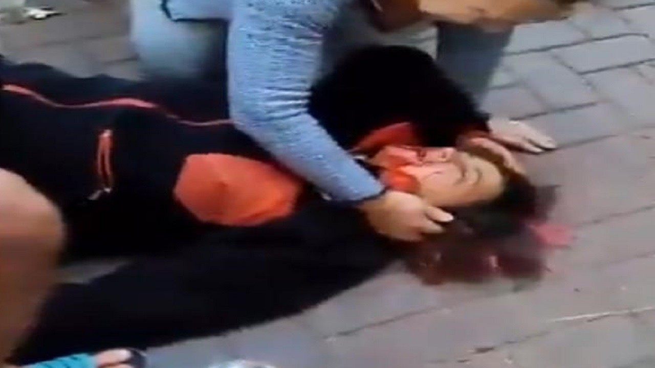 Mahalleli isyanda! Sokak köpekleri yürüşüye çıkan profesöre saldırdı