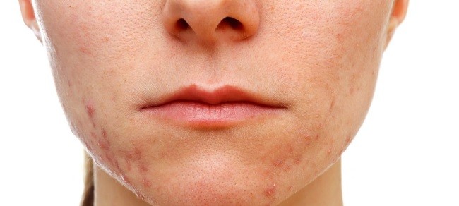 Makyaj yapmadan önce iyi düşünün