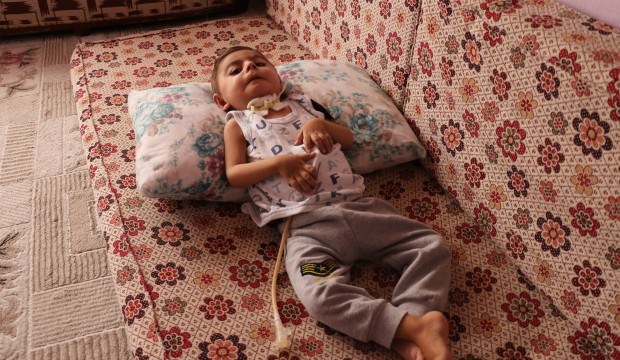Malatya'da küçücük bedeni ile yaşam savaşı veriyor