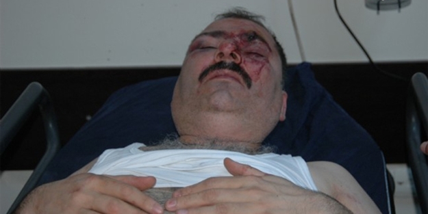 CHP'li Yavaş'ı eleştiren MHP'liyi komalık ettiler!