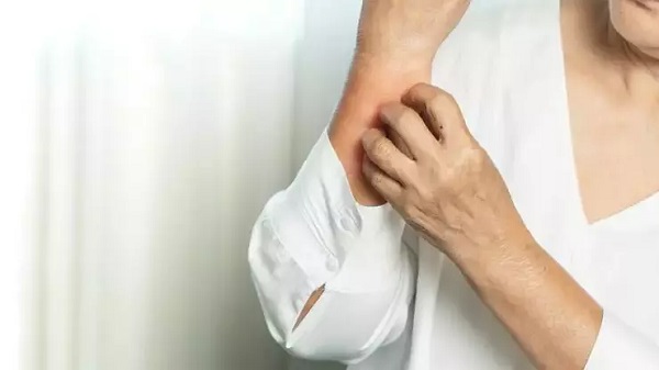 Mantar enfeksiyonundan korunmak mümkün mü?