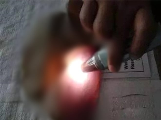 Mantar toplarken büyük hazine buldu! Sadece bir gramı 5 bin TL! Üst kısmını soyunca bakın ne çıktı