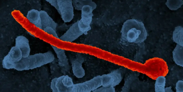 Marburg virüsü tehlikesi! Bulaştığını 9 gün sonra kan kaybından öldürüyor!