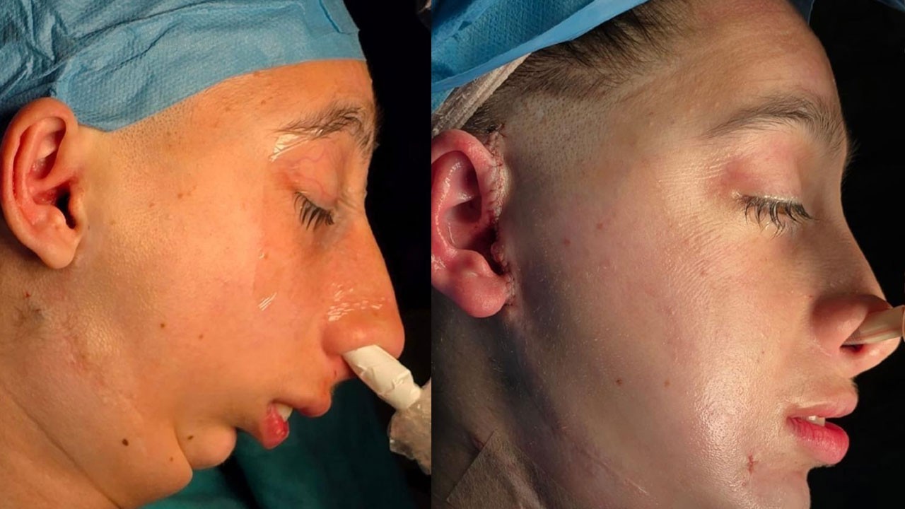 Mariam hayata yeniden başladı! Genç kız umuda Türkiye'de kavuştu