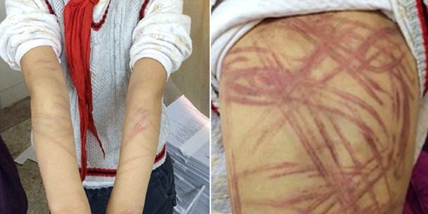 Masalı bilmeyen çocuğunu bu hale getirdi!